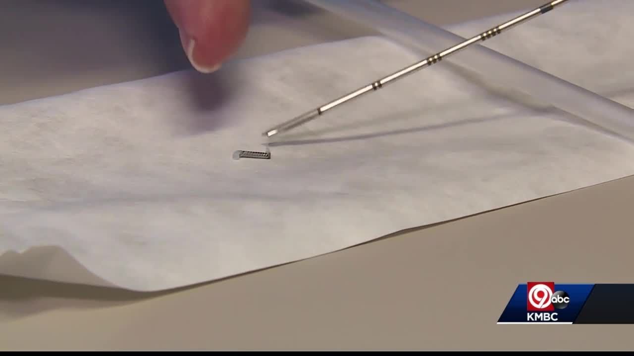 Device less invasive in marking cancer for breast cancer patients YouTube