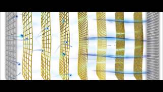 iCare Market Needs Video 2 0
