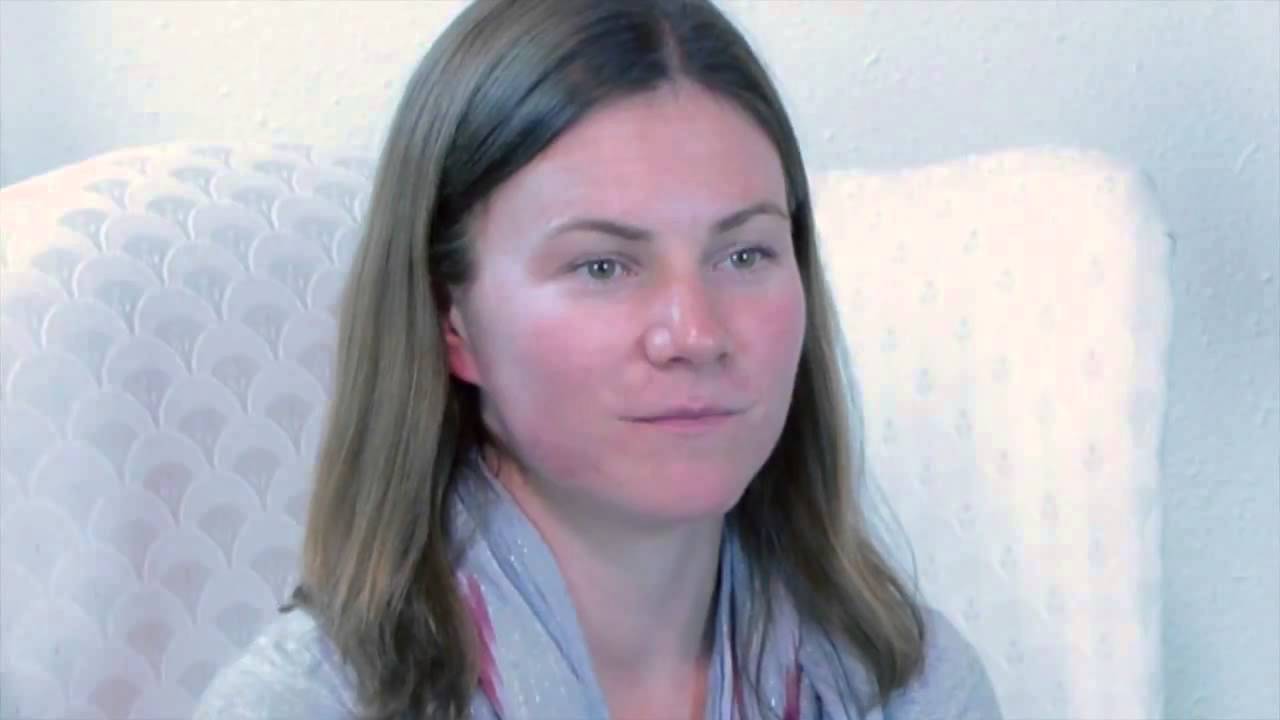 Albuquerque Acne Treatment