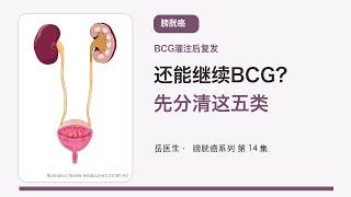 BCG灌注后复发怎么办？五种状态、足量标准与保膀新疗法
