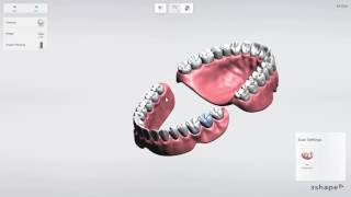 Implant Studio - 1.Edentulous case. How to set up a case