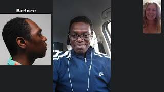 Fort Lauderdale Hair Transplant Clinic | Hair Transplants For Black Men
