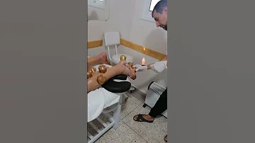الحجامة العلاحية لمشاكل اسفل القدم بطنجة وتطوان 0641454959 Tanger Tetouan Hijama 