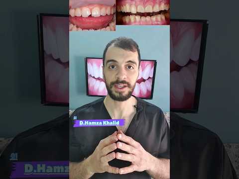 لا تخاف من حساسية الأسنان