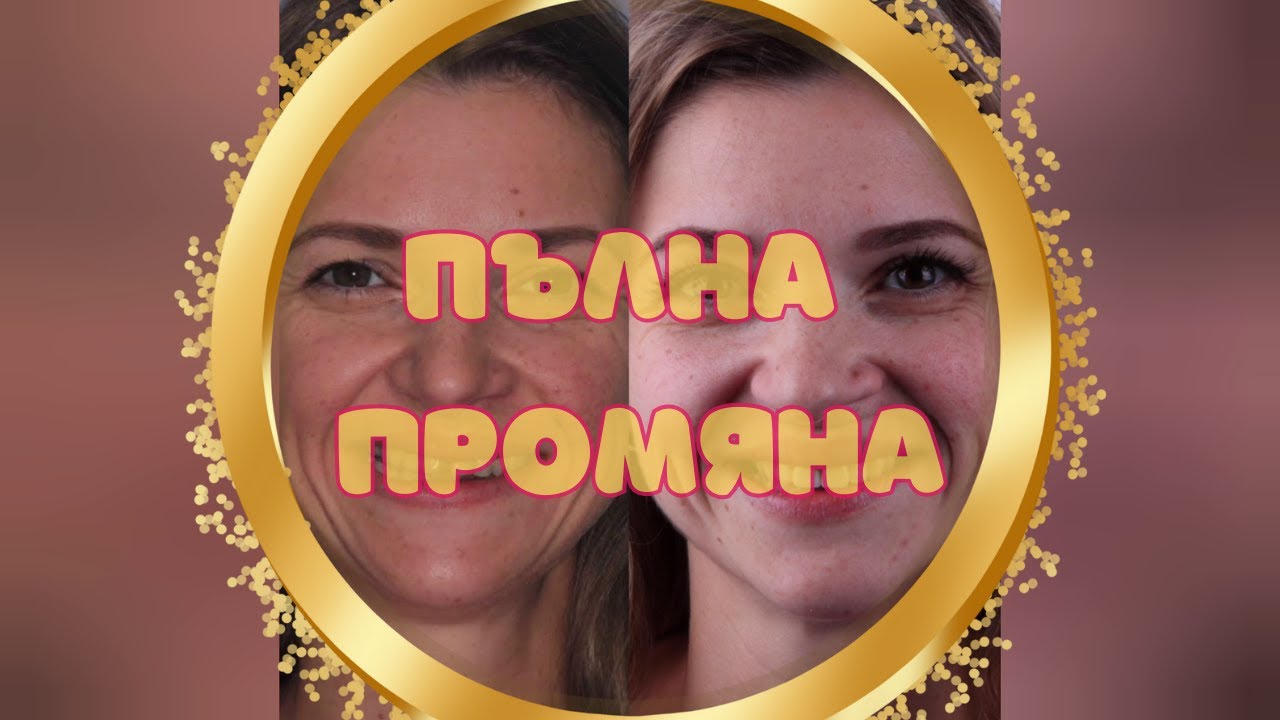 Циркониеви Коронки на Предни зъби [Пълна промяна]