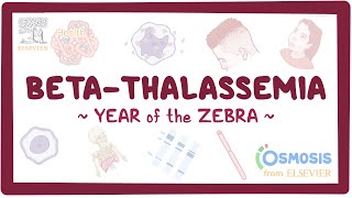 Beta-thalassemia (Year of the Zebra)