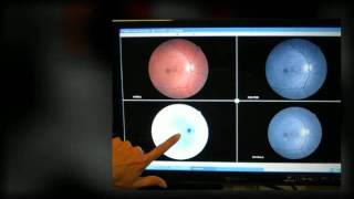 Williamson Eye Care, Douglasville Location - Retinal Scan