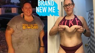 Lost 200lbs, Removed My Excess Skin  Look At Me Now | BRAND NEW ME