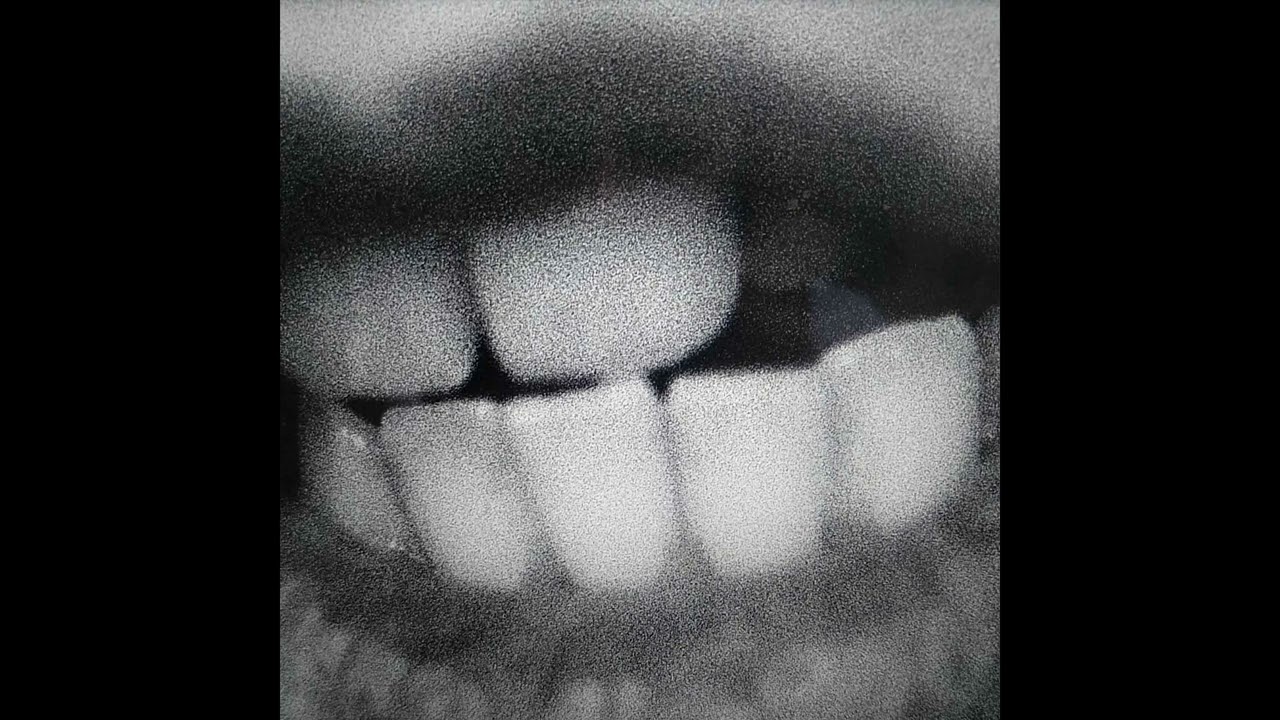 [FREE] JID TYPE BEAT || "JAWZ"