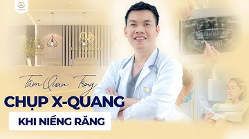 Điều Gì Xảy Ra Khi Bạn Không Chụp X-quang Trước Khi Niềng Răng | Bác sĩ Trung Long Biên