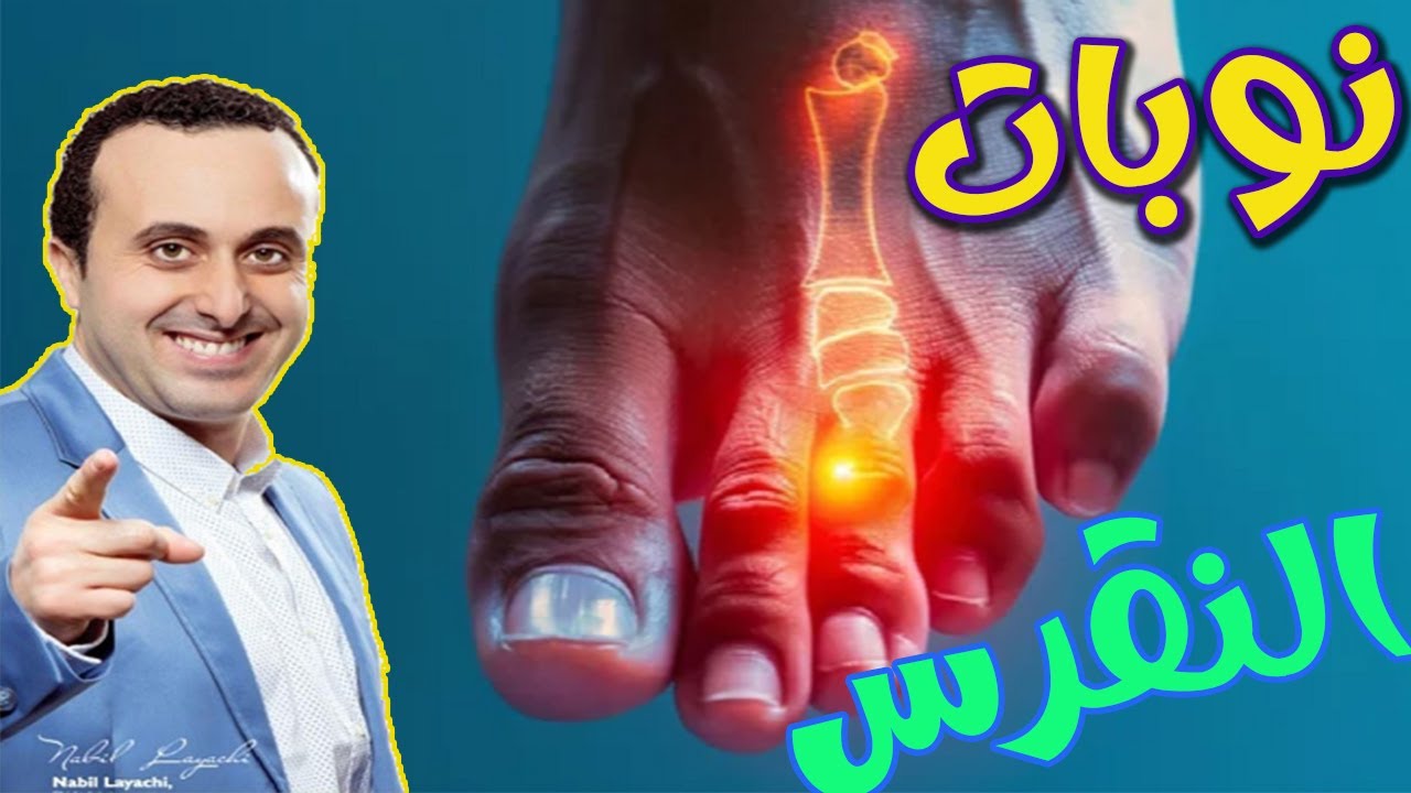 نوبات التقرس أو داء الملوك سر إن عرفته لن تصاب به إطلاقا  مع أخصائي التغذية نبيل العياشي