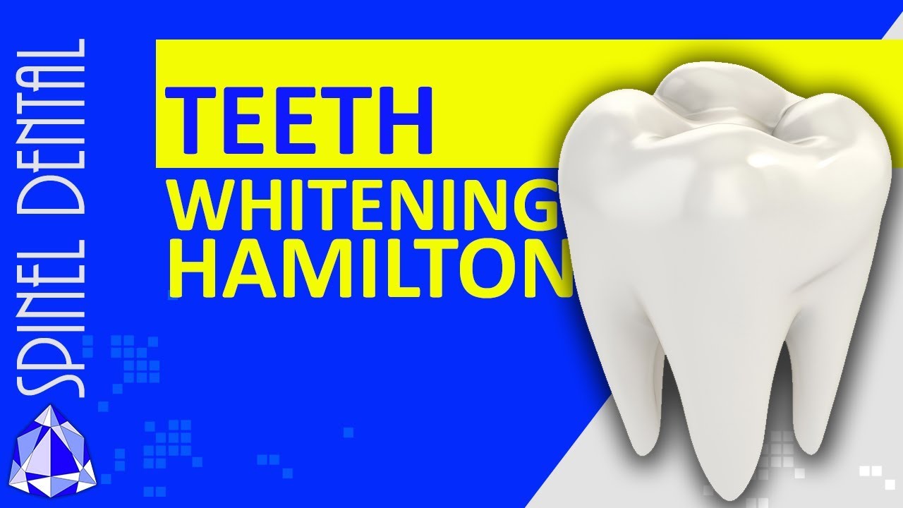 Teeth Whitening 2022 Don't hide your smile! Dentist Hamilton Teeth