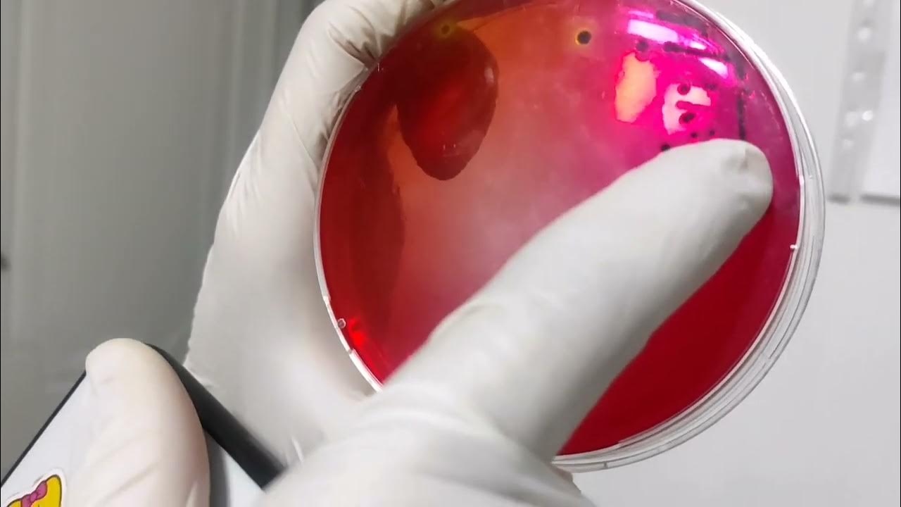 Stool Culture Salmonella pathogenic Proteus Normal Flora stool-culture-salmonella-pathogenic-proteus-normal-flora