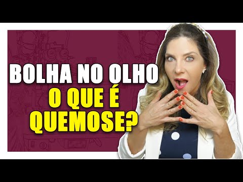 Quemose - O Que é Quemose (Bolha no Olho)