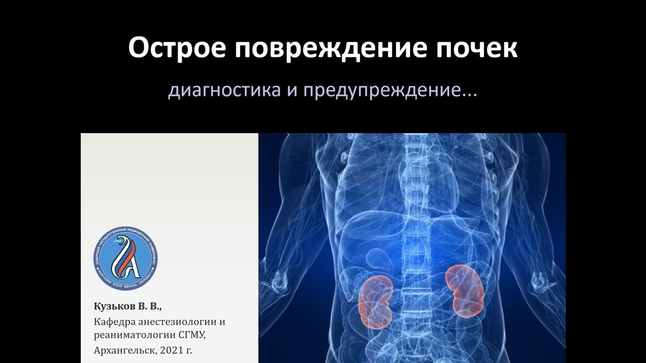 Острое повреждение почек и ХБП - YouTube