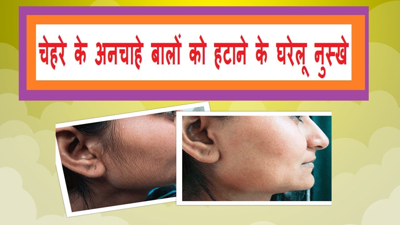 Face hair removal tips चहेर ेक ेअनचाह ेबालो ंको हटान ेक ेघरले ूनसुख् े