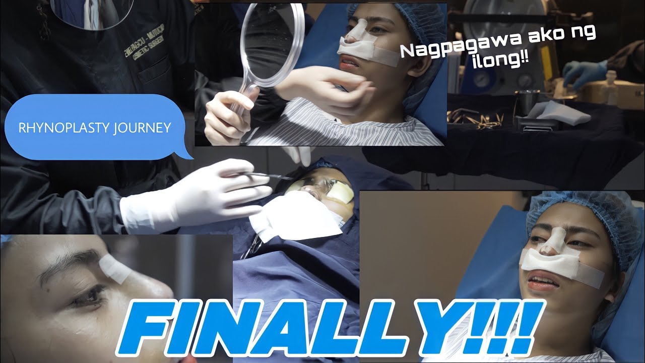 Download NAGPAGAWA AKO NG ILONG - Rhynoplasty Journey | Riri Navarro