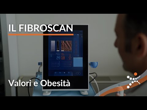 Video: Come diagnosticare la fibrosi epatica?