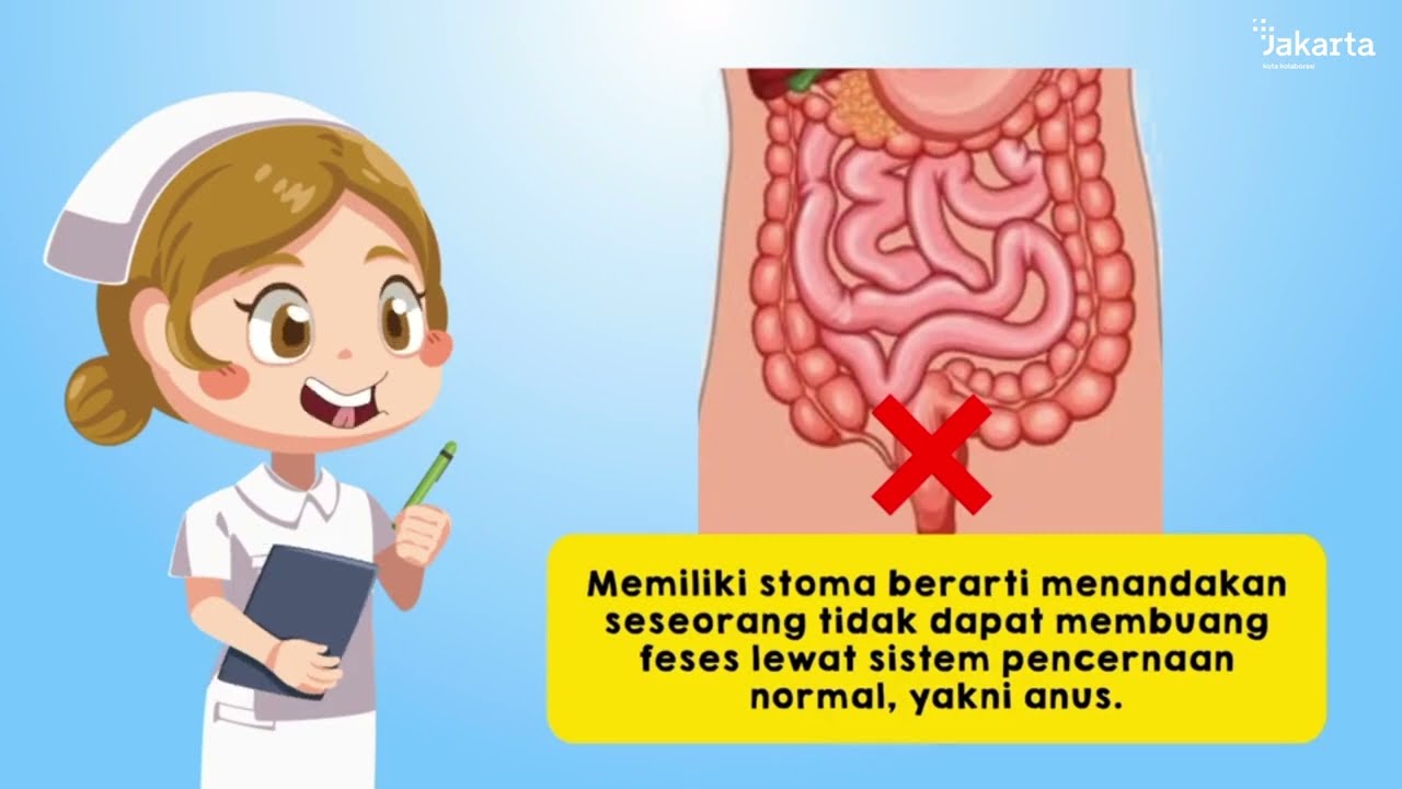 Cara Perawatan Stoma agar tetap sehat