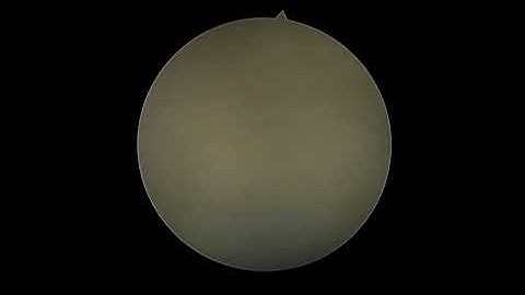 3 lobes HolEP Pr Benatta