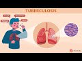 tuberculosis prevention and control
