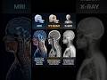 MRI vs CT Scan vs X-Ray: Kya Farq Hai? 🏥 | MedWalaPrince #Shorts