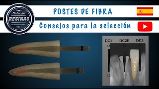 Postes de fibra  Consejos para la selección