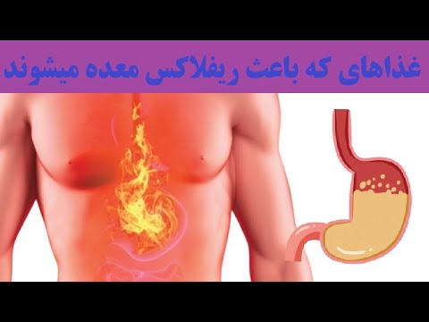 غذاهای که باعث ریفلاکس معده میشوند