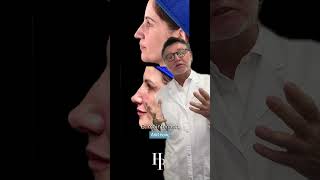 La Minute du Dr Raspaldo : Eiffel Tower Nose Lift 🎥