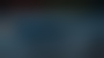 LANDMARK-Guided Subclavian Central Line - Troubleshooting Guidewire Advancement