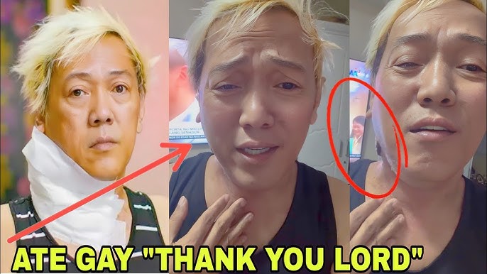 Ate Gay LUMIIT ang BUKOL sa Leeg! - YouTube