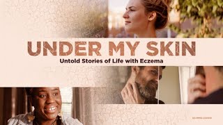 Under My Skin Eczema Documentary