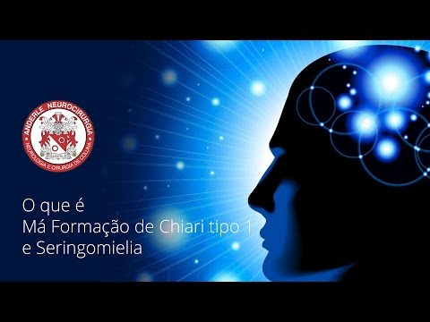 O que é Má Formação de Chiari tipo 1 e Seringomielia - Dr Diogo Neurocirurgião