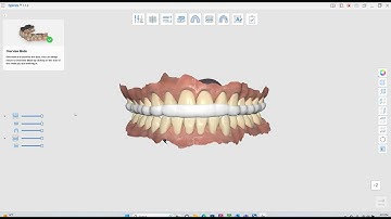 Medit Splint Creation with A.I.