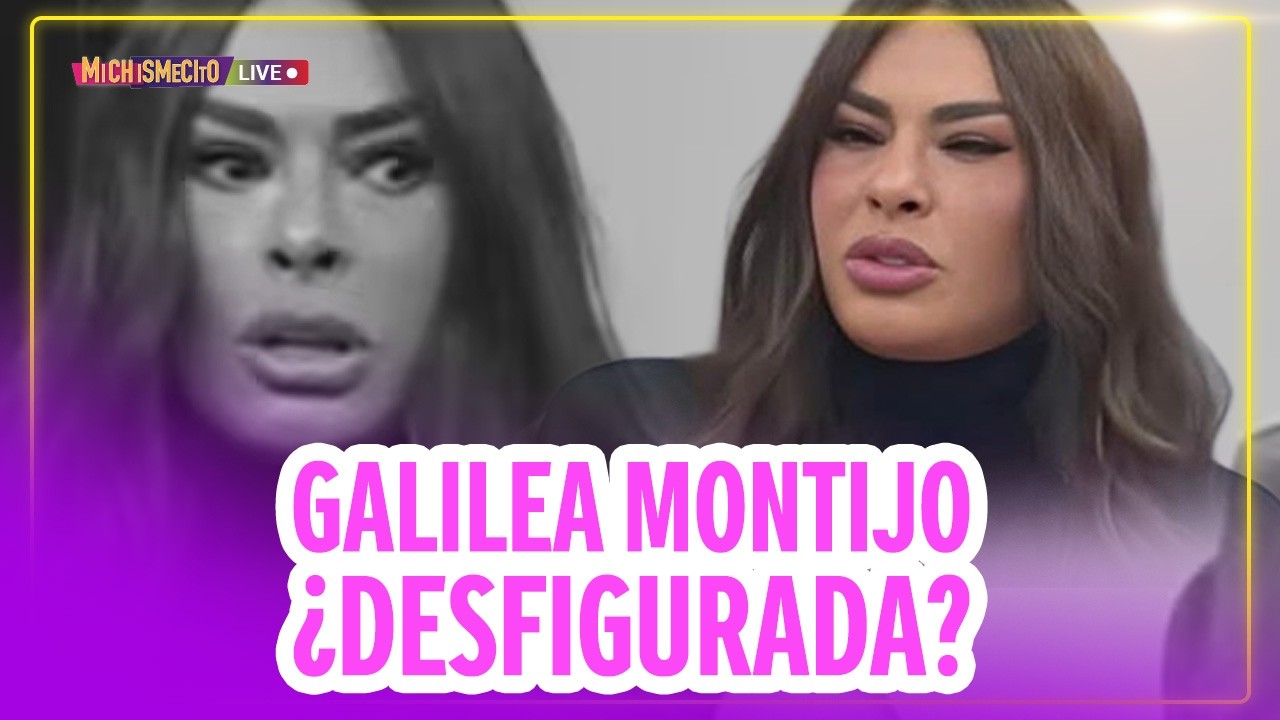 Galilea Montijo ¿Desfigurada? / MICHISMECITO