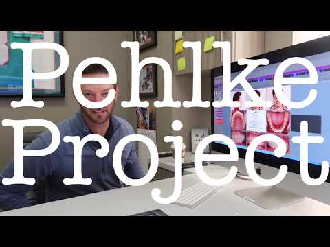 Invisalign Process!!! - Northern Virginia Orthodontics