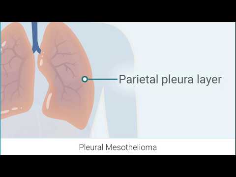 Pleural Mesothelioma Overview | Mesothelioma Guide
