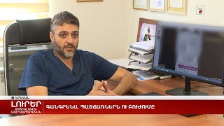 Գանգրենա. Պատճառներն Ու Բուժումը