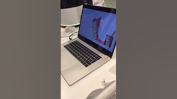 A look at the new TRIOS 3 wireless scanner at IDS 2017