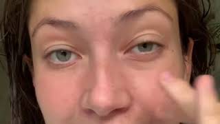 5 Pro Make Up Tips for Problem Skin