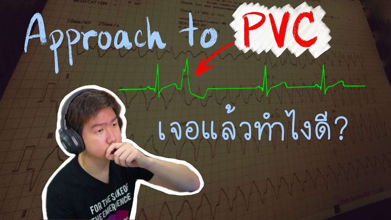 เจอ PVC ต้องทำยังไง | Frontline EKG