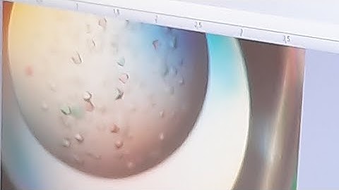 Protein Crystallography