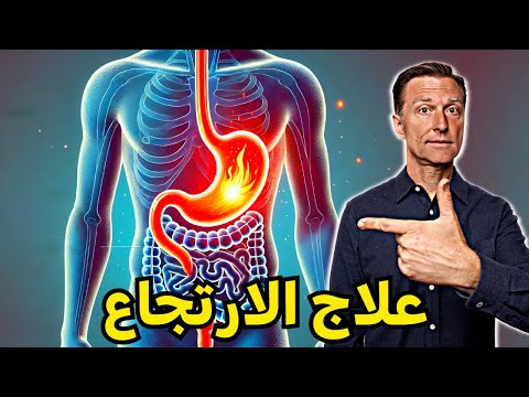 دكتور بيرج | علاج الحرقة أو حموضة المعدة  (الارتجاع المعدي)