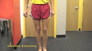 The Wobbly Runner Dissected | Chris Johnson PT