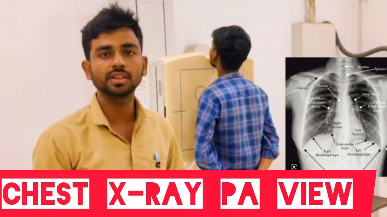 Chest PA view |chest x ray pa view #viral #shortvideo #shortsvideo # ...