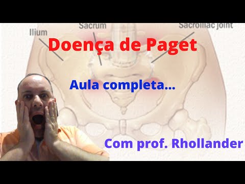 Vídeo: Síndrome De Paget-Schrötter - Causas, Sintomas E Tratamento