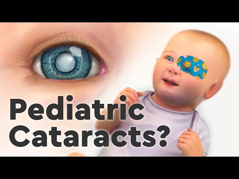 Pediatric Cataracts and the Importance of Care