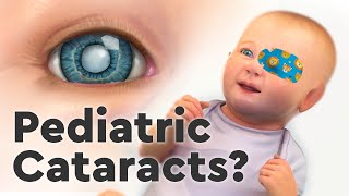 Pediatric Cataracts and the Importance of Care