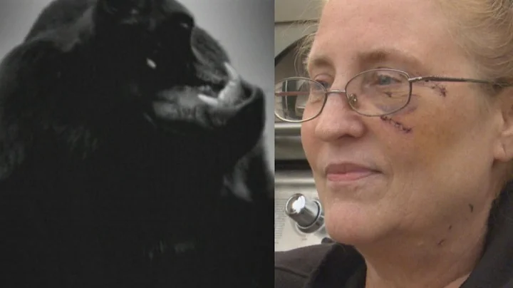 Woman Relives The Moment She Almost Died In Horrif...