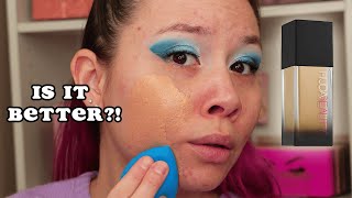 Huda #FauxFilter Foundation on ACNE